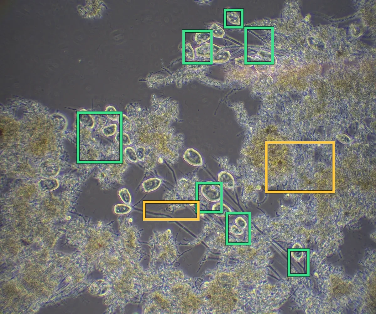 Microscope slide with the AI's detection boxes: stalked ciliates outlined in green, filaments and open floc in yellow